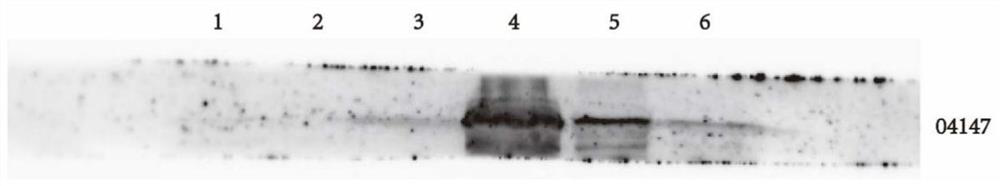 Application of polysaccharide lyase coding gene 04147 in preparation of recombinant peach gum polysaccharide hydrolase