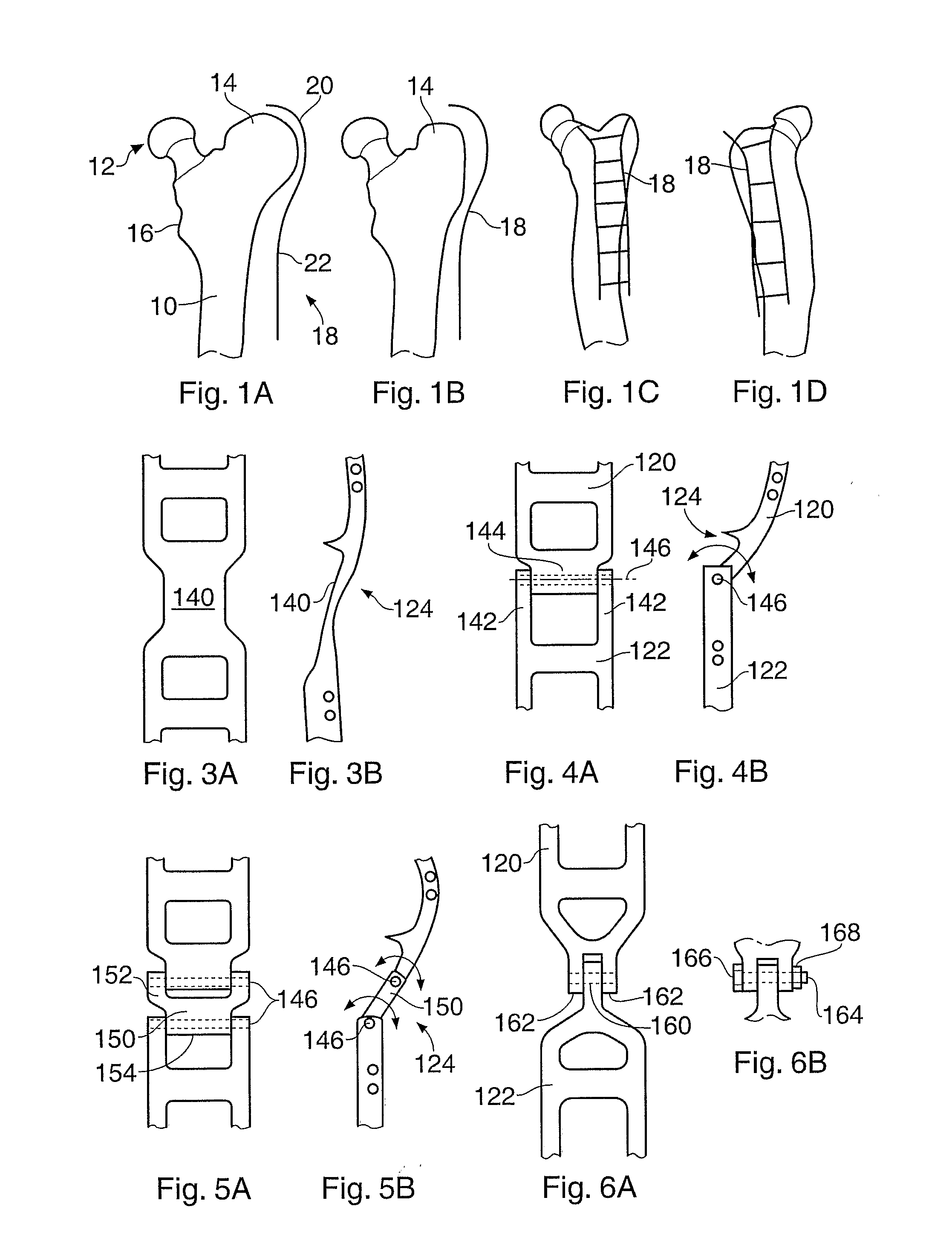 Configurable Bone Fixation System