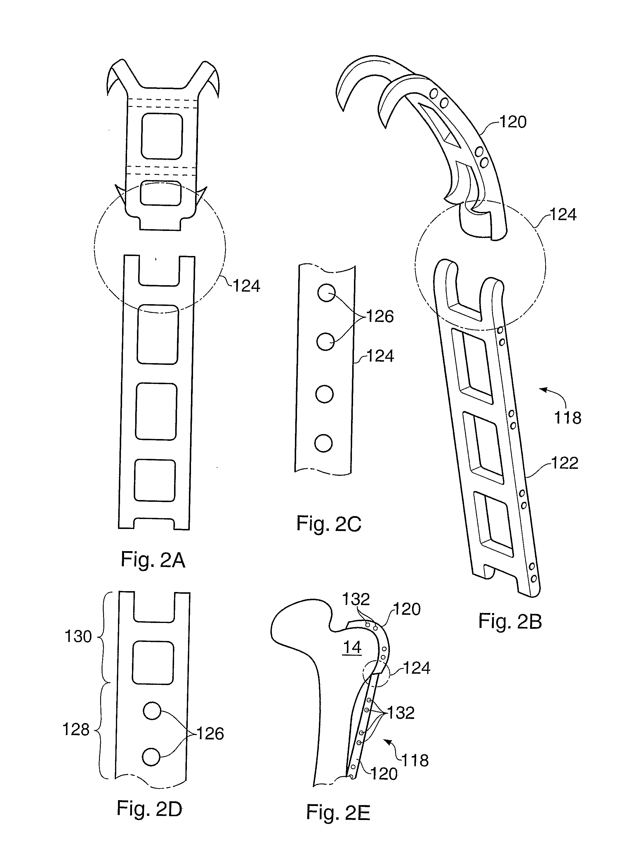 Configurable Bone Fixation System