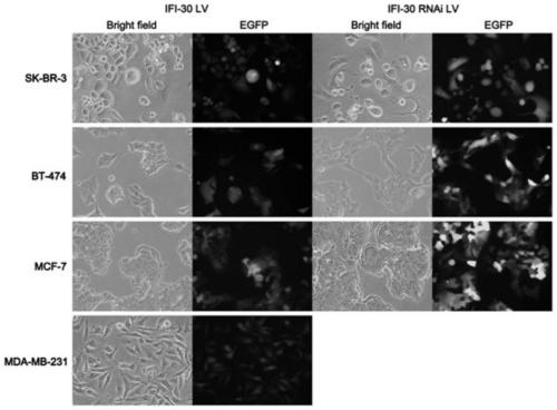 Application of protein/gene IFI30 related to breast cancer occurrence and development