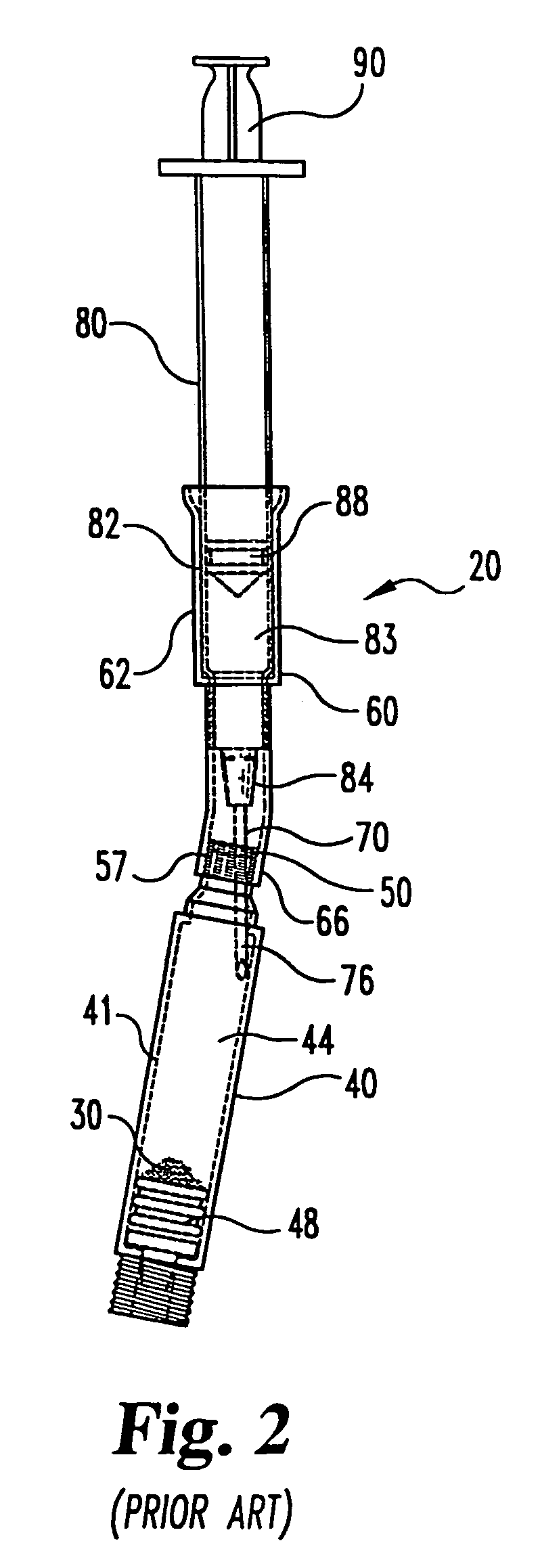 Kit including side firing syringe needle for preparing a drug in an injection pen cartridge