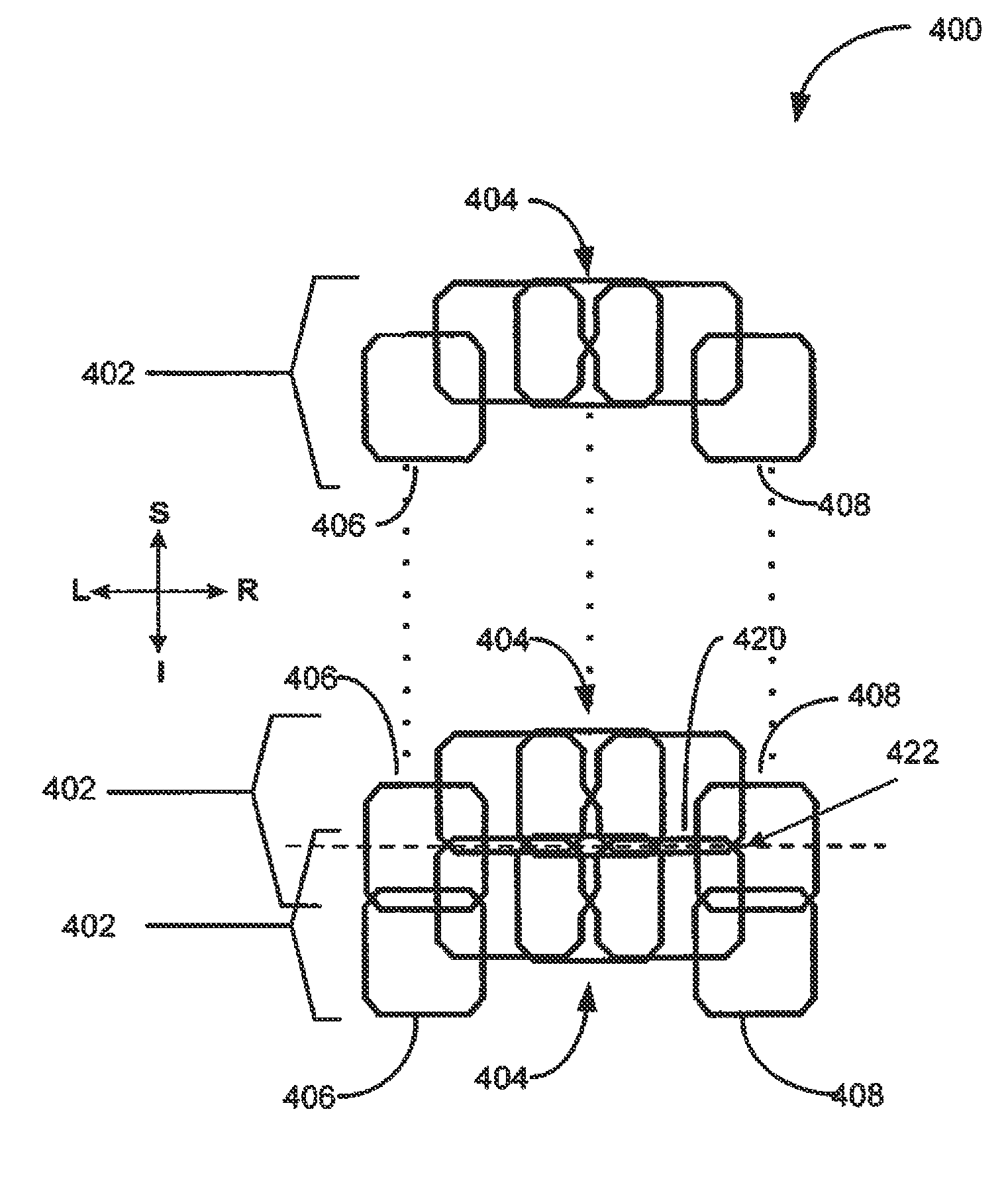 Quadrature and linear RF coil array for MRI of human spine and torso