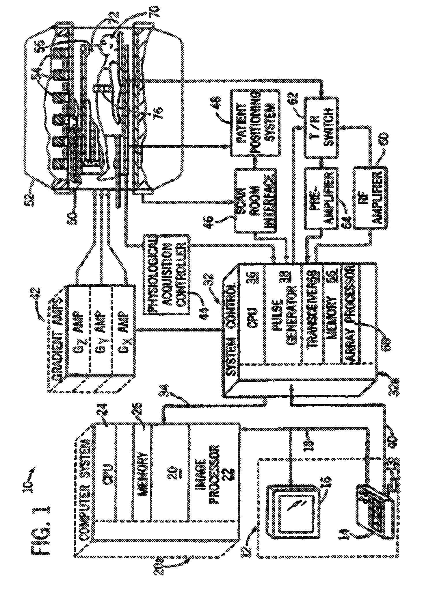 Quadrature and linear RF coil array for MRI of human spine and torso