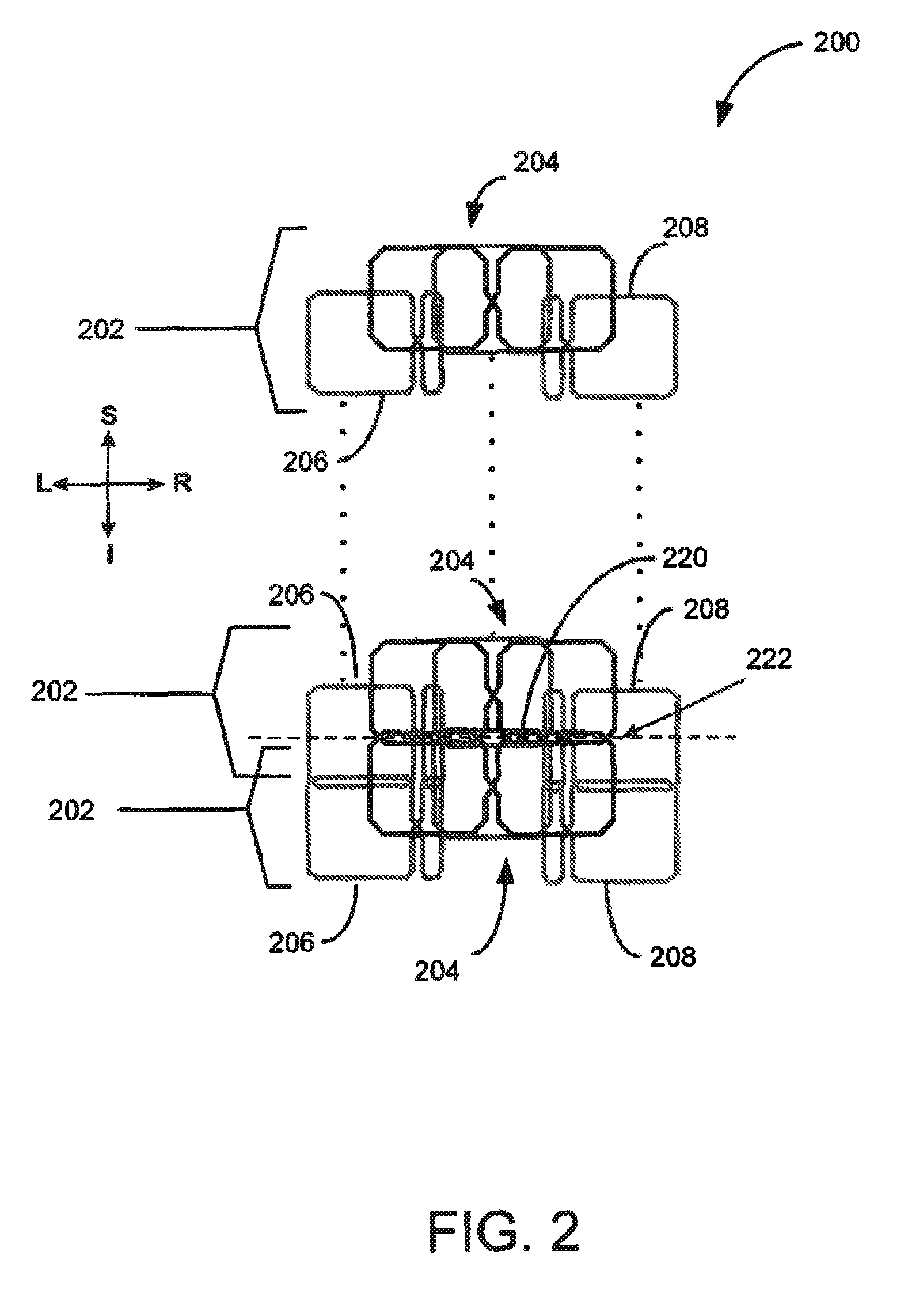 Quadrature and linear RF coil array for MRI of human spine and torso