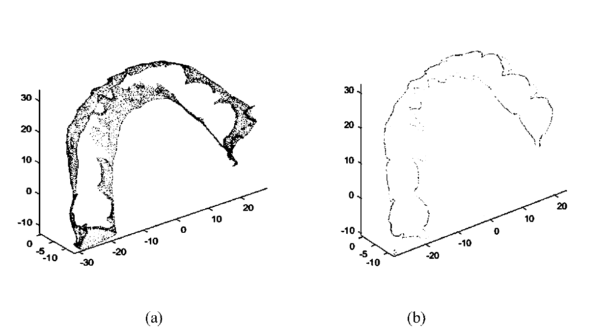 Tooth occlusion analysis system based on point cloud spatial characteristics