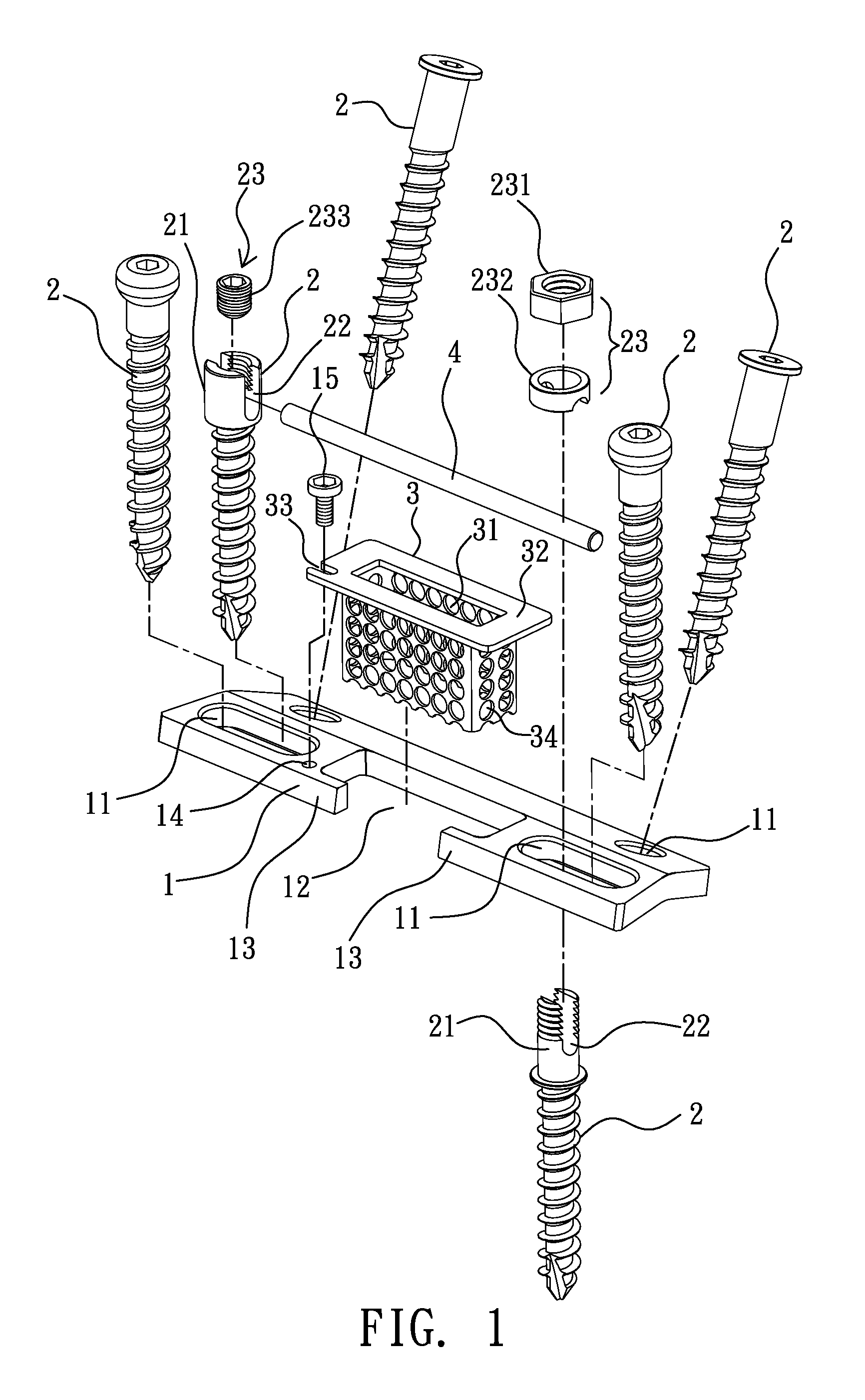 Vertebral Fixation Plate Assembly