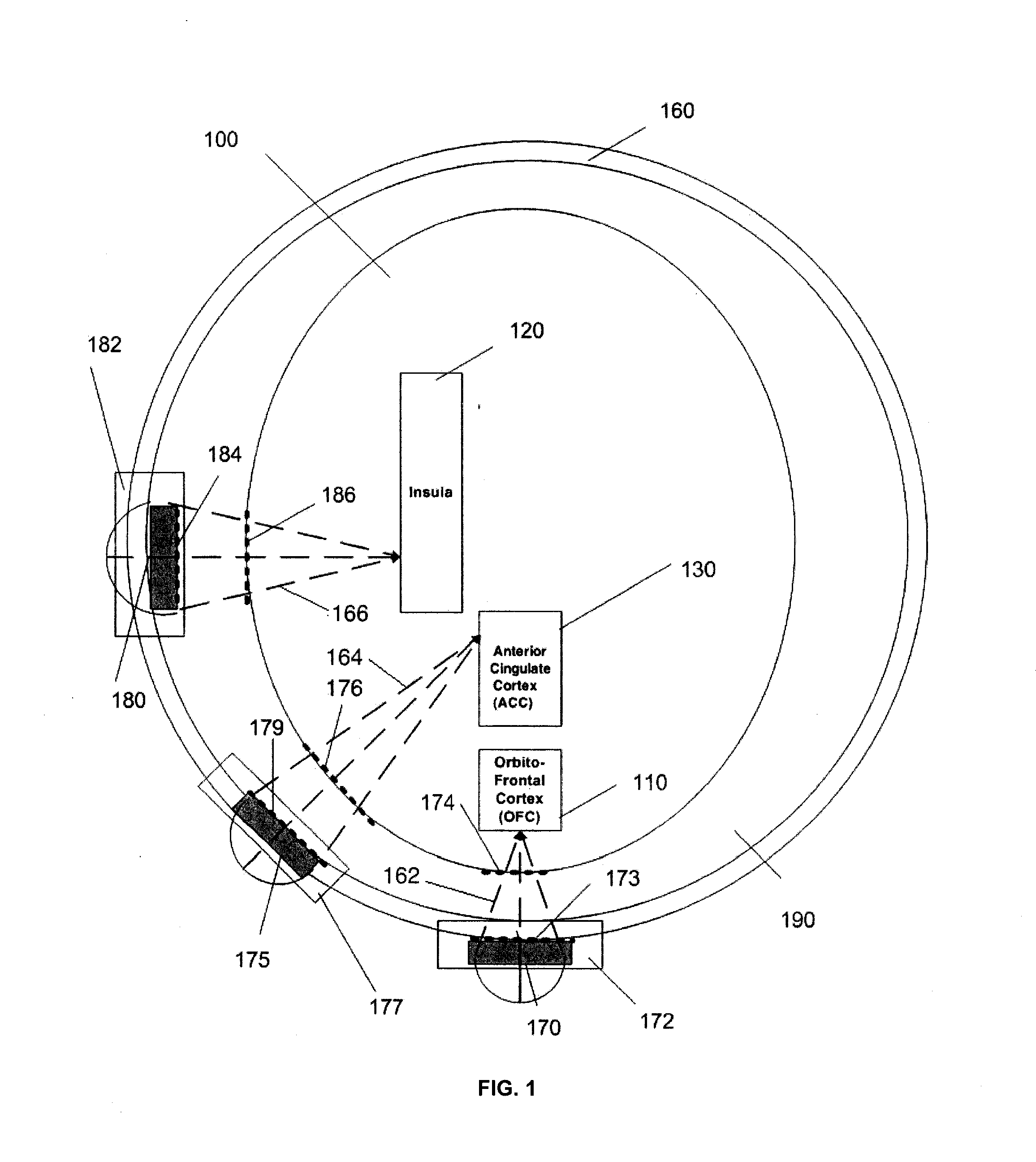 Ultrasound neuromodulation treatment of depression and bipolar disorder