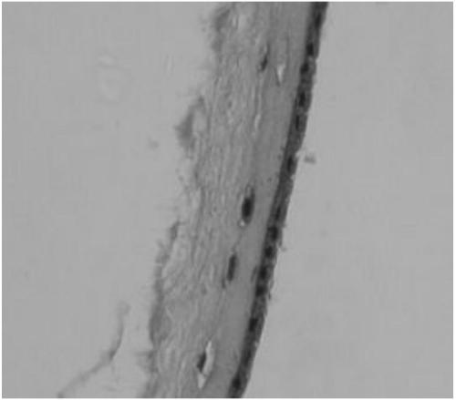 A preparation method and application of decellularized amniotic membrane for skin refractory wound repair