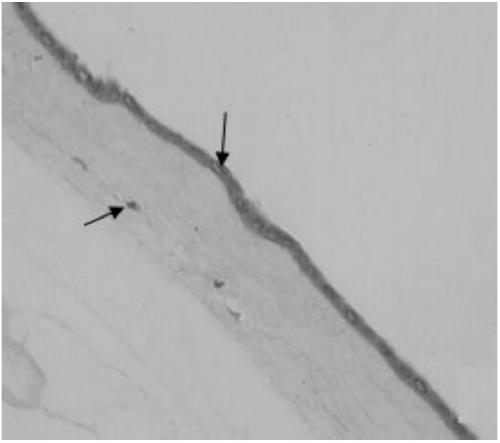 A preparation method and application of decellularized amniotic membrane for skin refractory wound repair