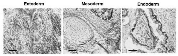 GPD1L-deleted human embryonic stem cell strain and construction method and application thereof