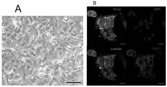 GPD1L-deleted human embryonic stem cell strain and construction method and application thereof