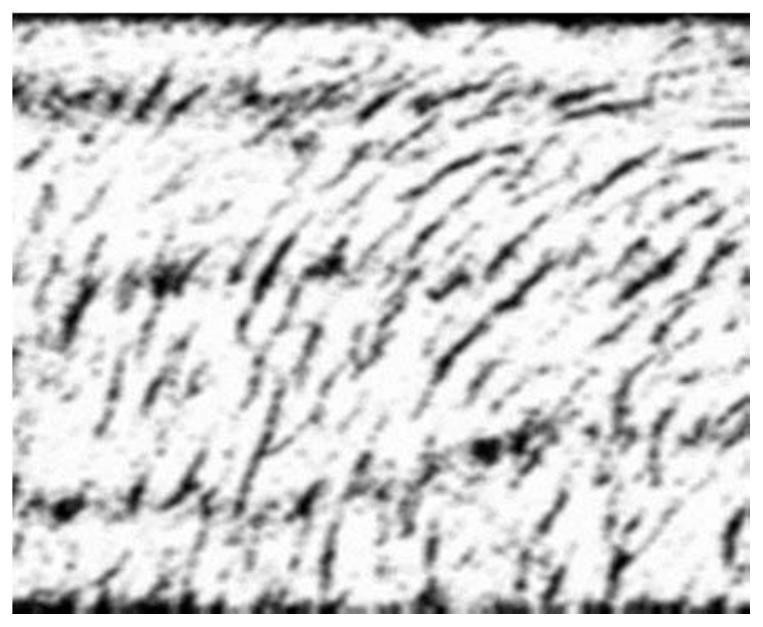 Near-infrared vein image processing method for filtering hair noise