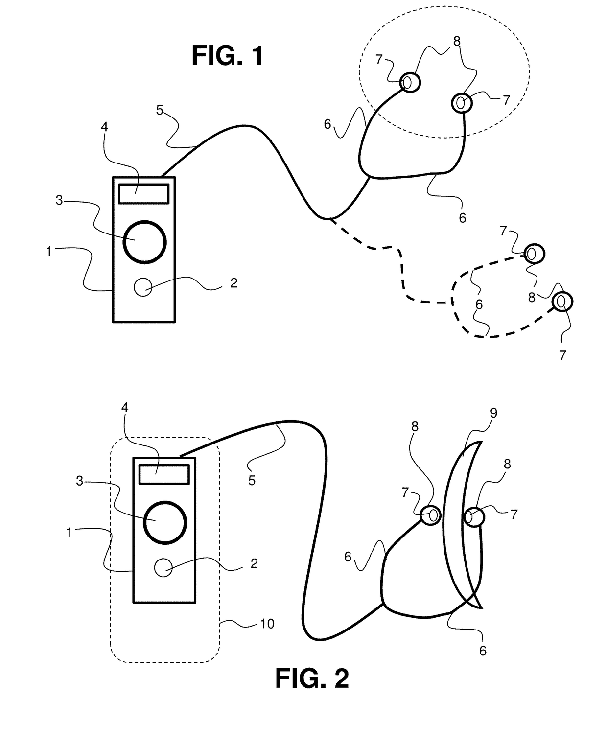 Transcutaneous electrostimulator and methods for electric stimulation