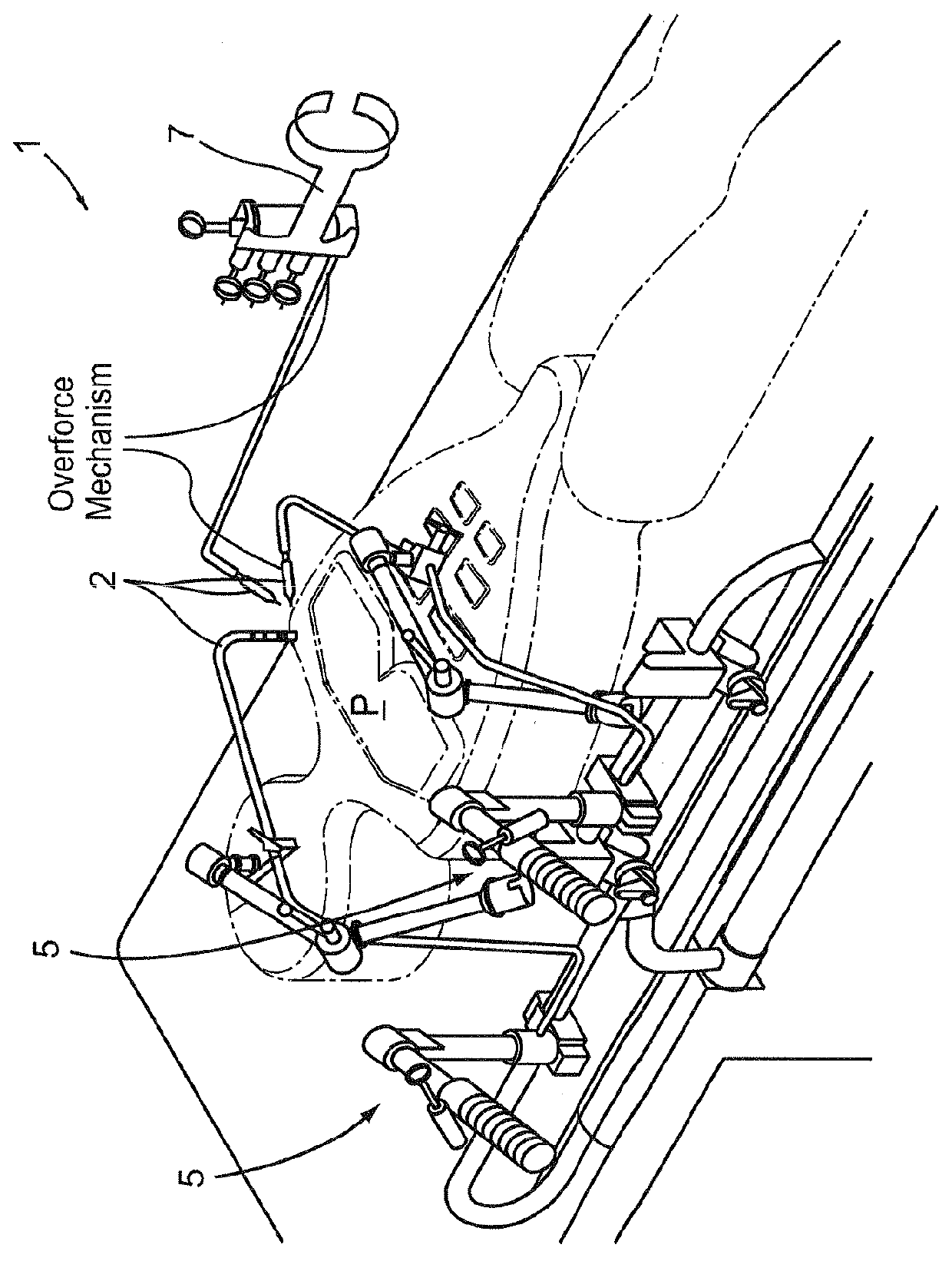 Overforce mechanism