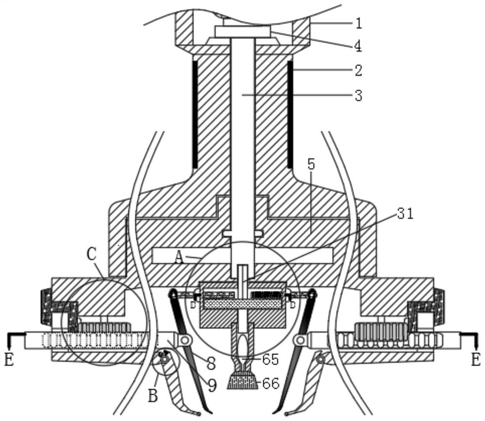 Minimally invasive scalpel capable of automatically cutting off local skin lumps