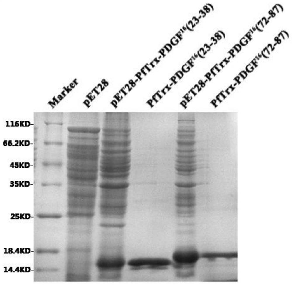 A platelet-derived growth factor recombinant vaccine for treating pulmonary fibrosis and its application