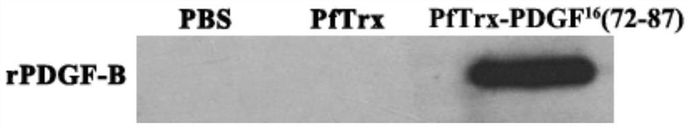 A platelet-derived growth factor recombinant vaccine for treating pulmonary fibrosis and its application