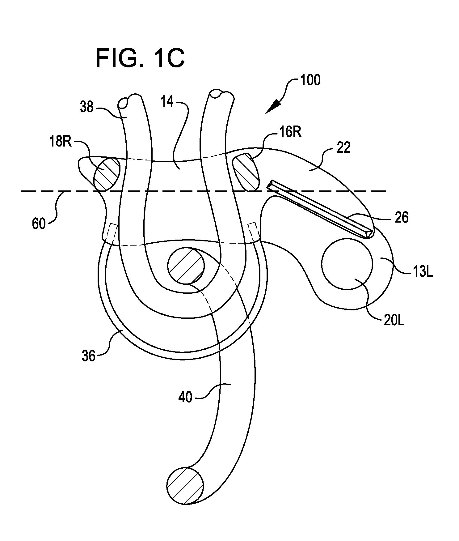 Rope handling device with secondary locking feature