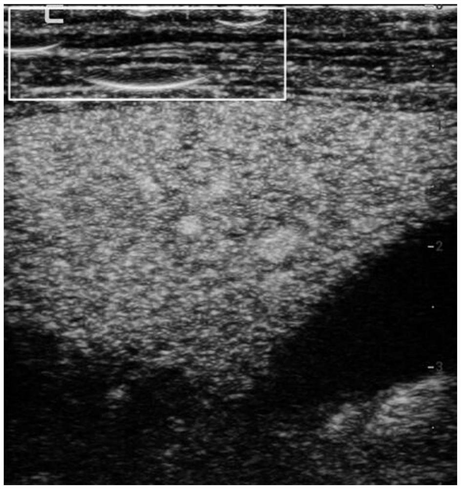 Ultrasound imaging equipment, system and image enhancement method for contrast-enhanced ultrasound imaging