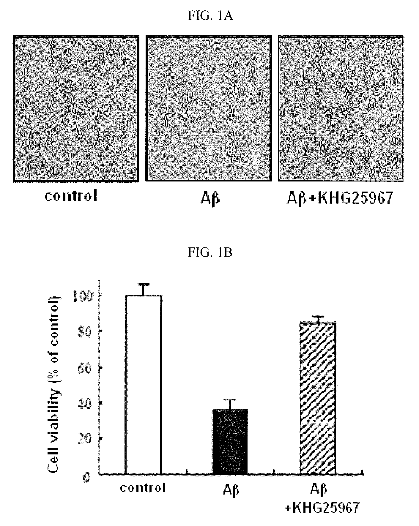 Benzoarylureido compounds, and composition for prevention or treatment of neurodegenerative brain disease containing the same