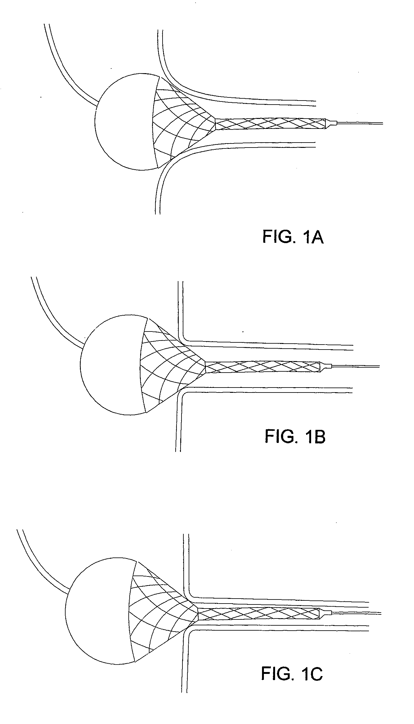 Axially compressible flared stents and apparatus and methods for delivering them