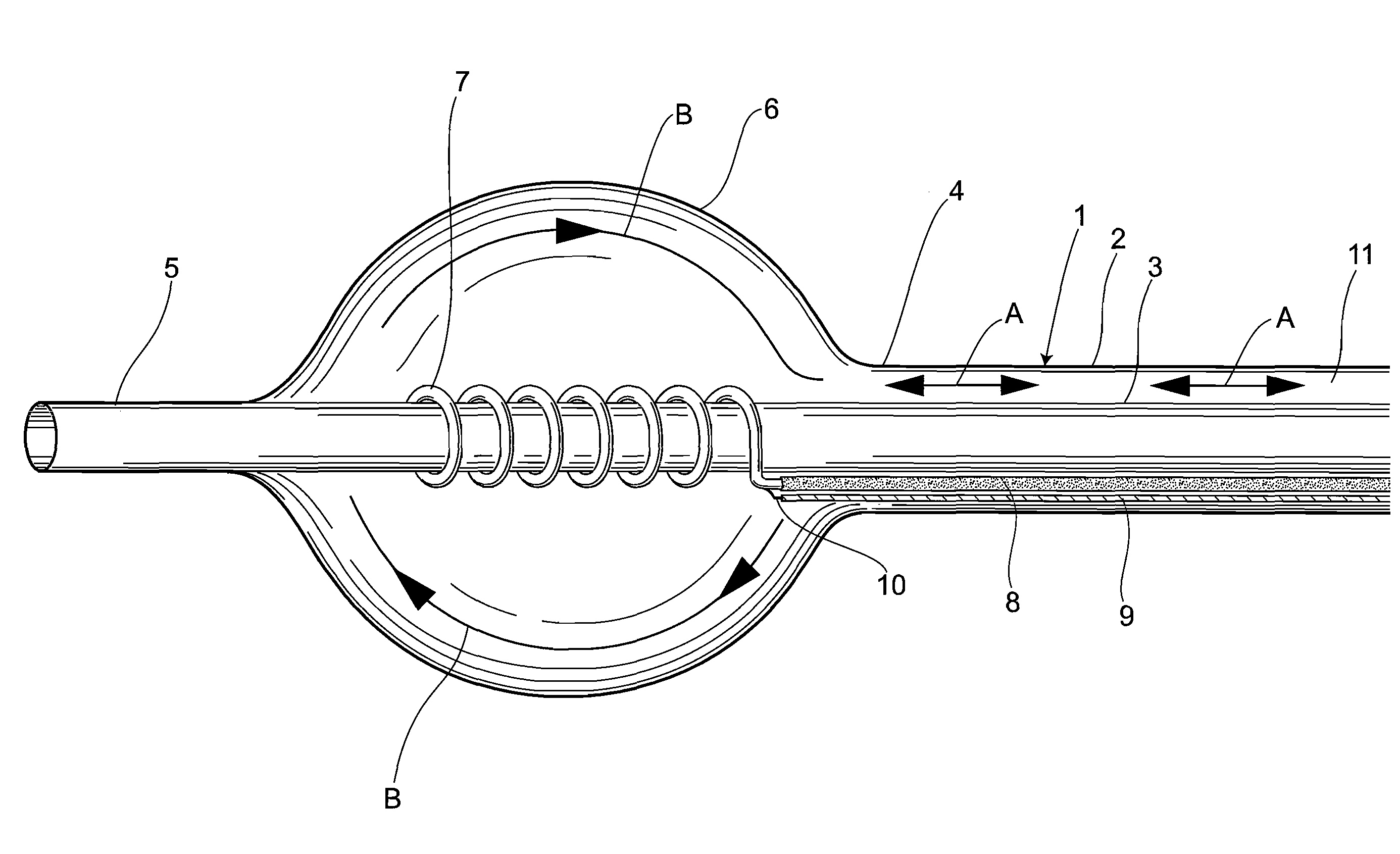 Radiofrequency thermal balloon catheter system