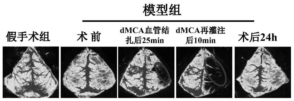 Method for establishing mouse middle cerebral artery remote ischemia reperfusion model