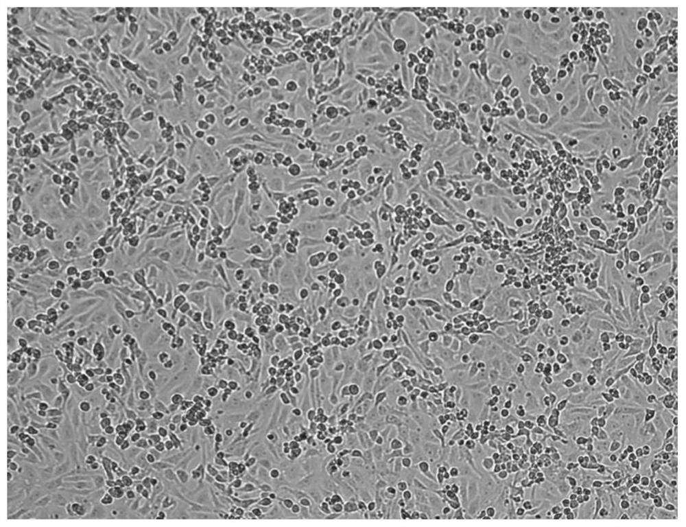 Novel coronavirus and culture method thereof as well as novel coronavirus inactivated vaccine