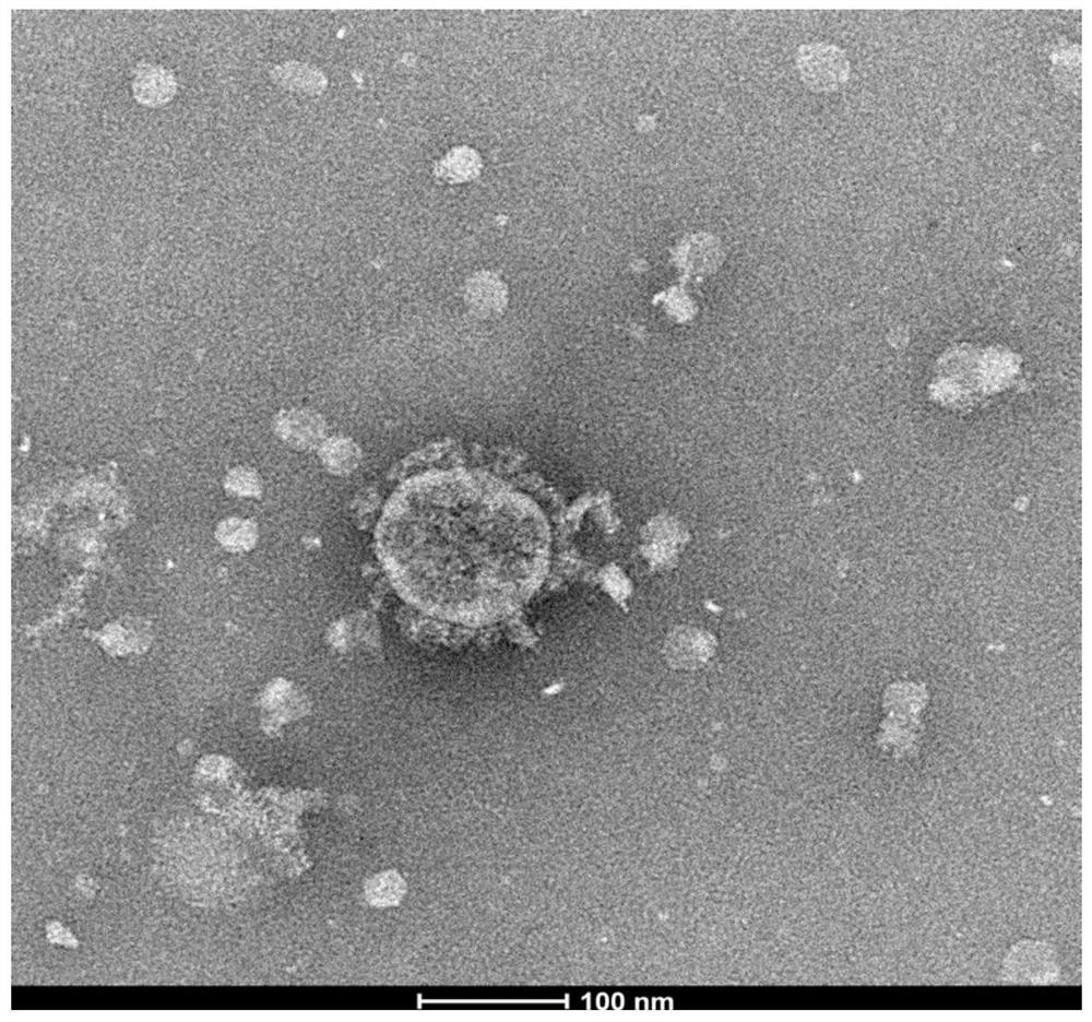 Novel coronavirus and culture method thereof as well as novel coronavirus inactivated vaccine