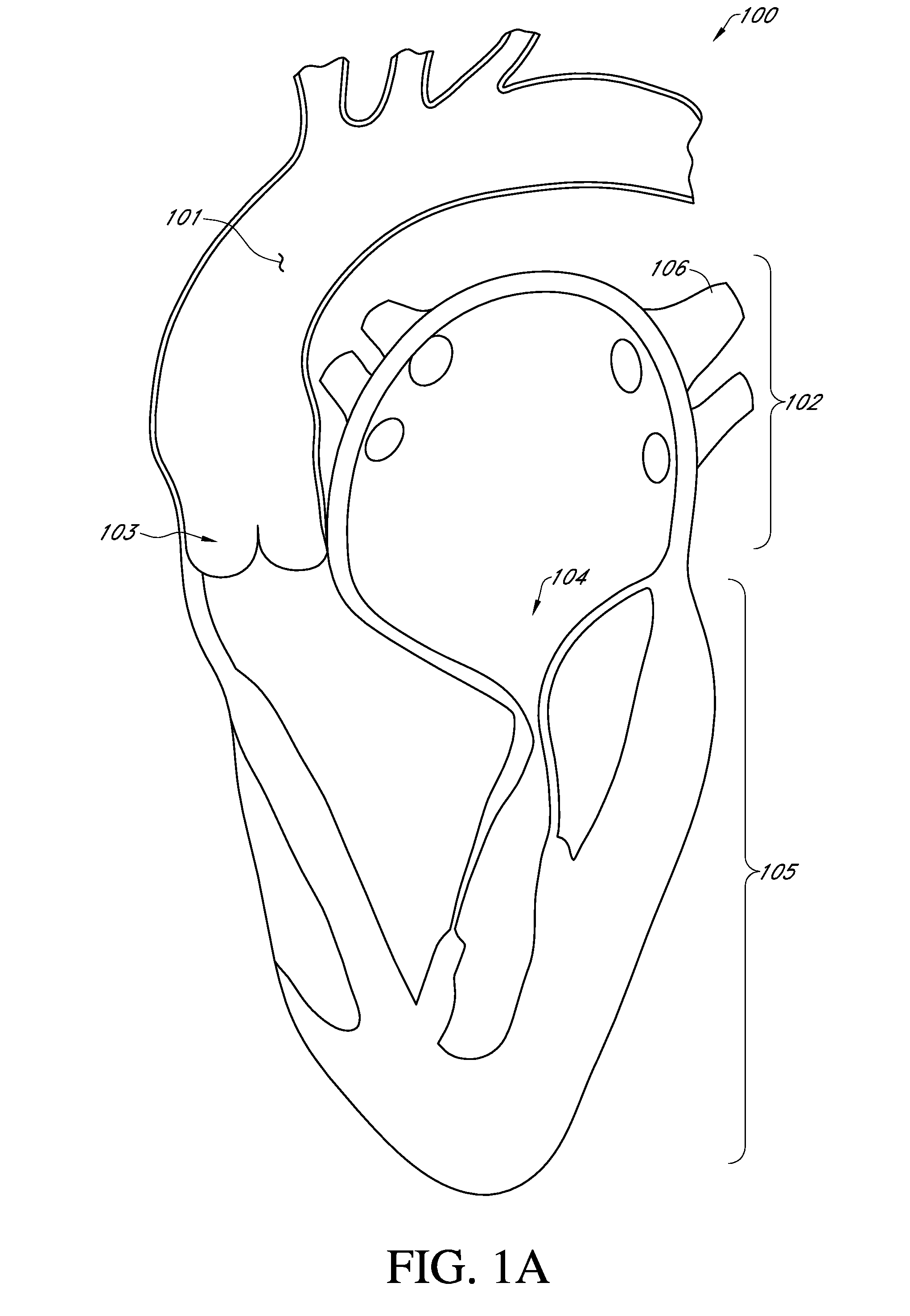 Method of reconfiguring a mitral valve annulus