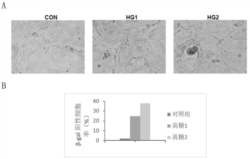 Preparation method and application of a high-concentration glucose solution-activated mesenchymal stem cell conditioned medium