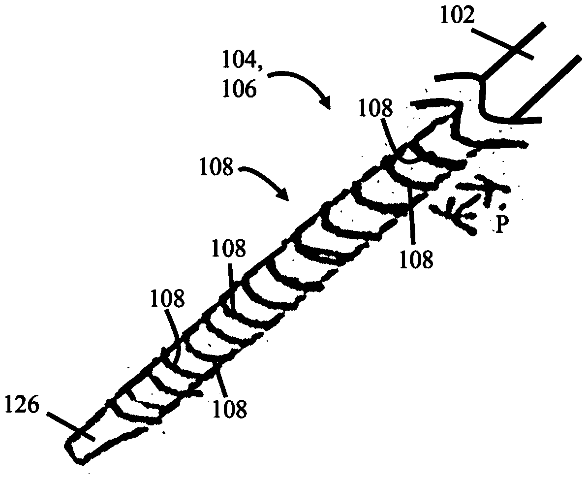 Ureteral stent