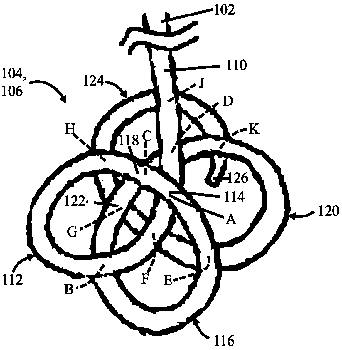 Ureteral stent