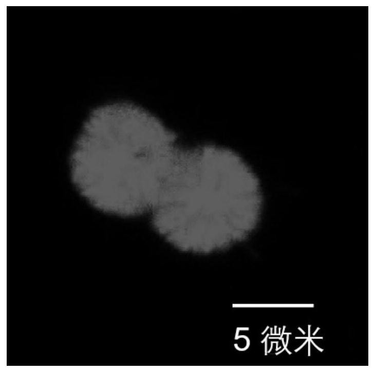 Preparation method and application of dopamine/calcium phosphate hybrid micron flower