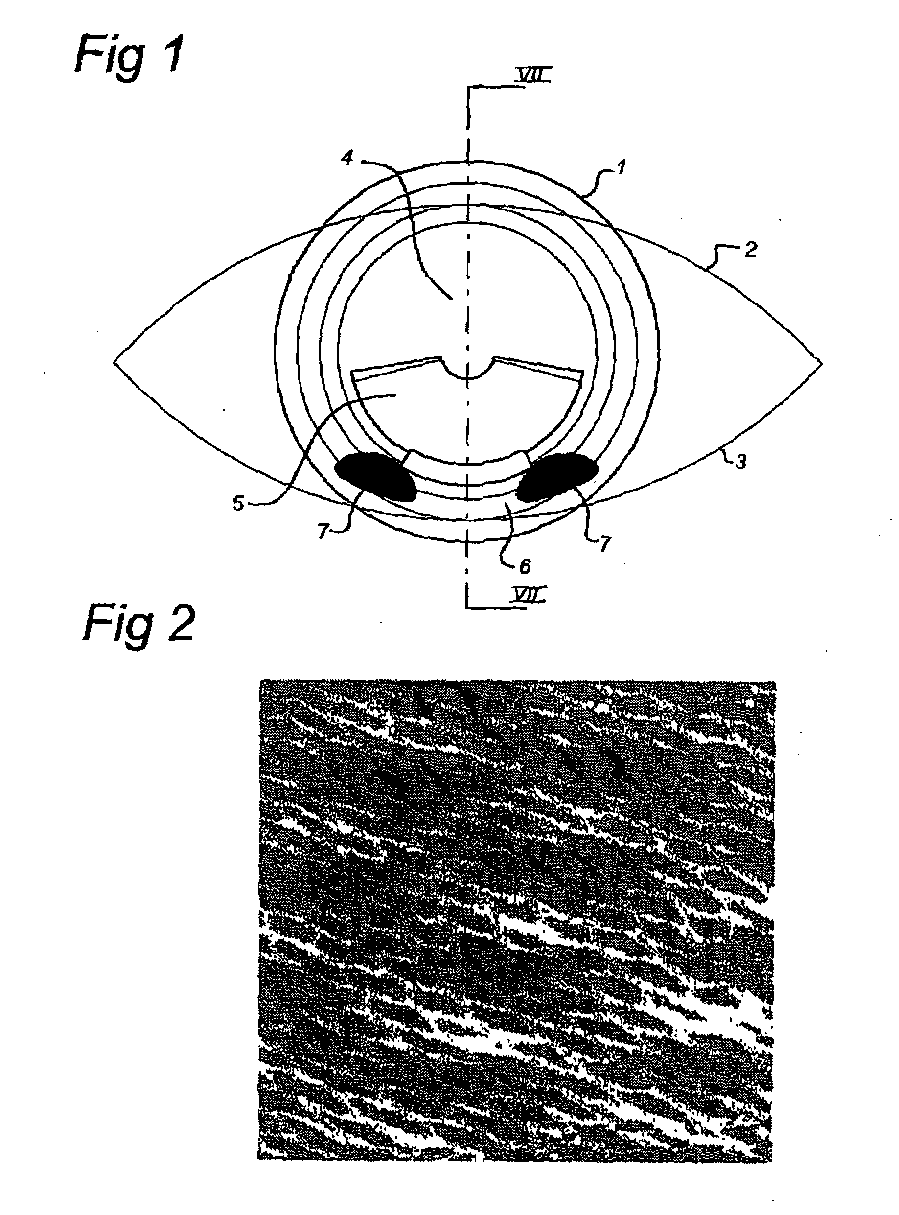 Contact lens