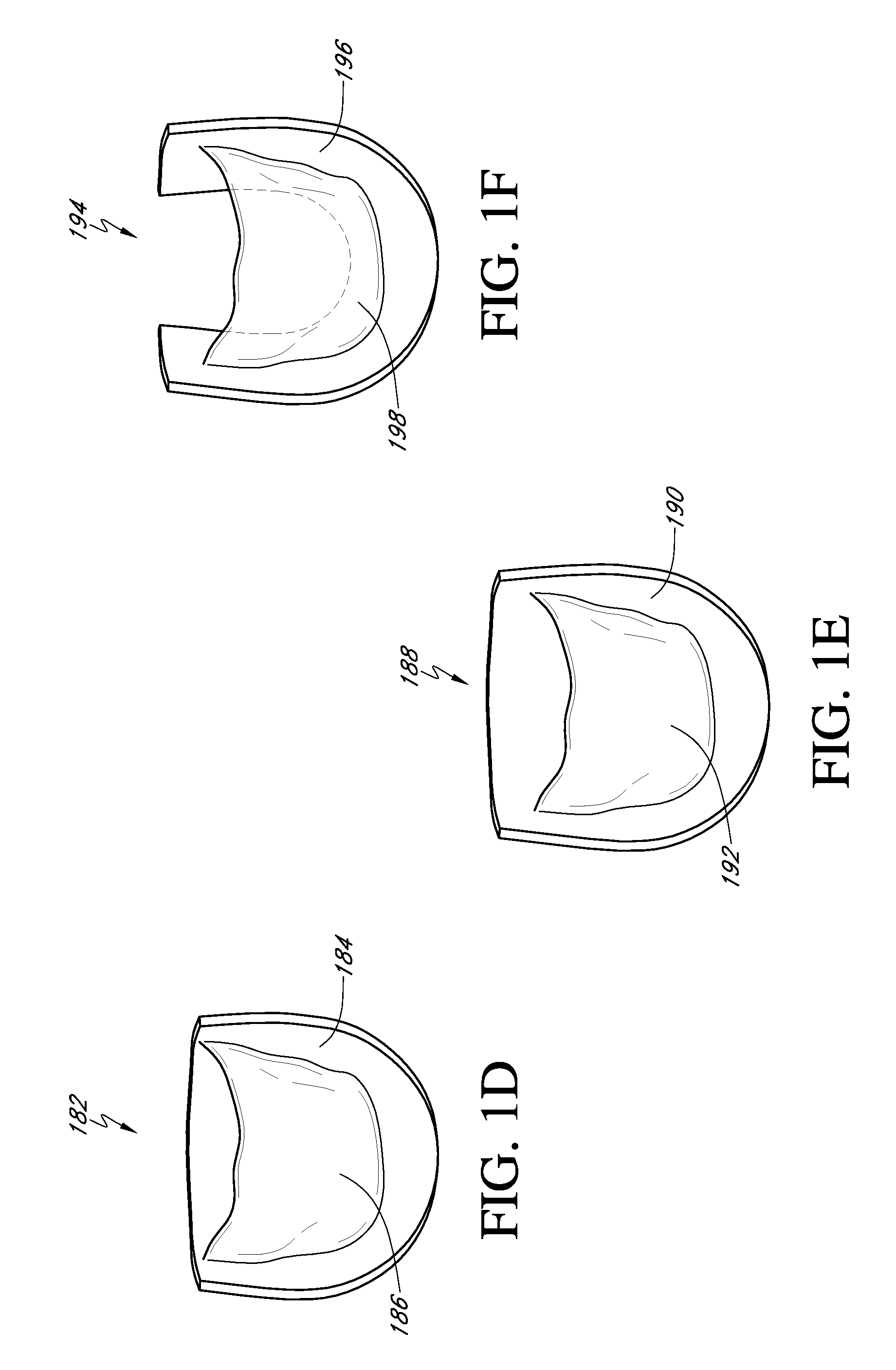 Biological valve for venous valve insufficiency