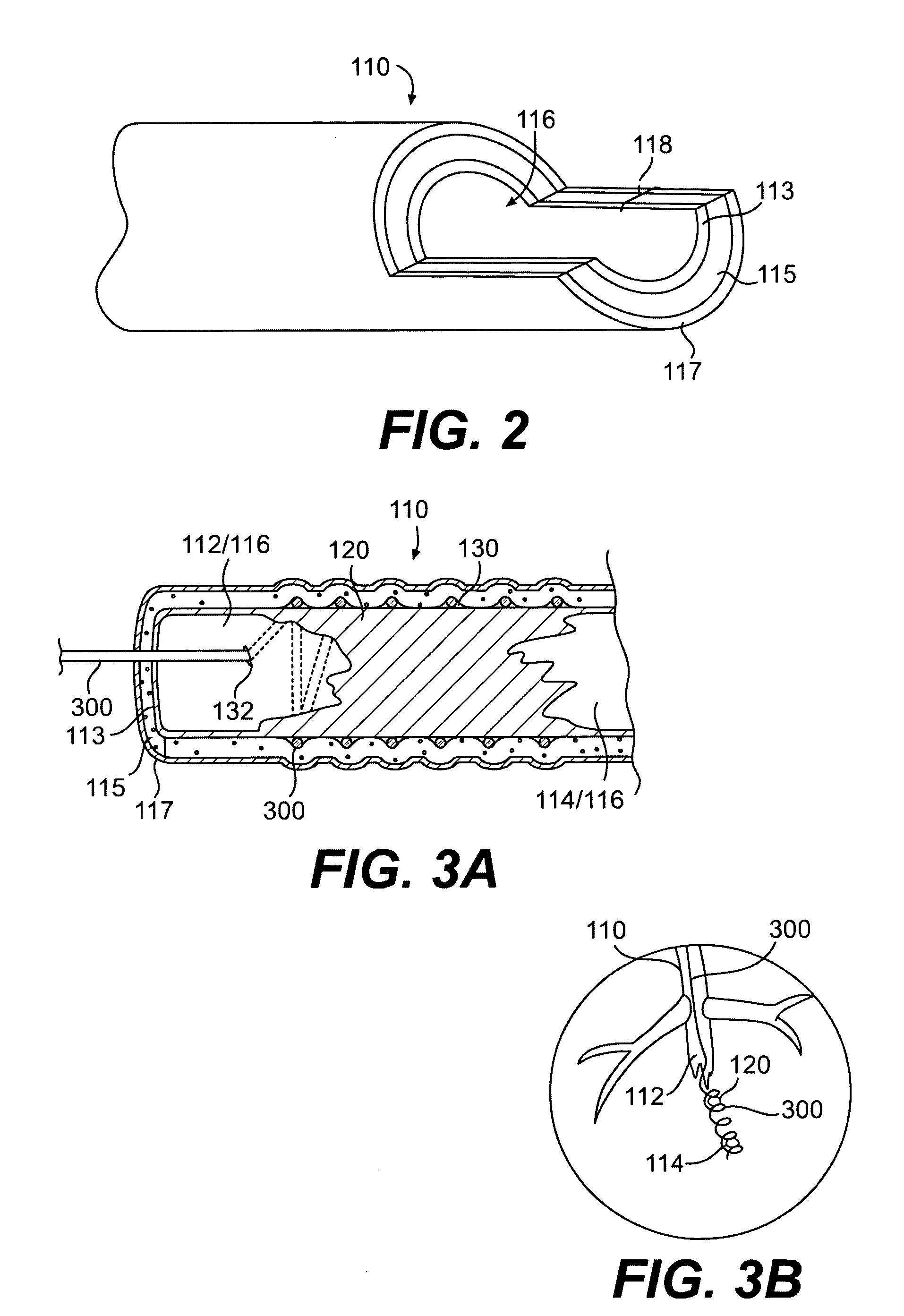 Endovascular devices and methods for exploiting intramural space