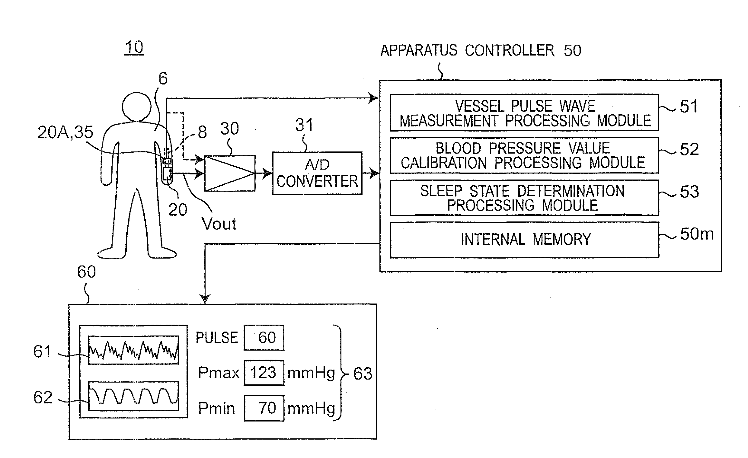 Vessel pulse wave measurement system conducting vessel pulse wave measurement by obtaining pulsation waveform of blood vessel