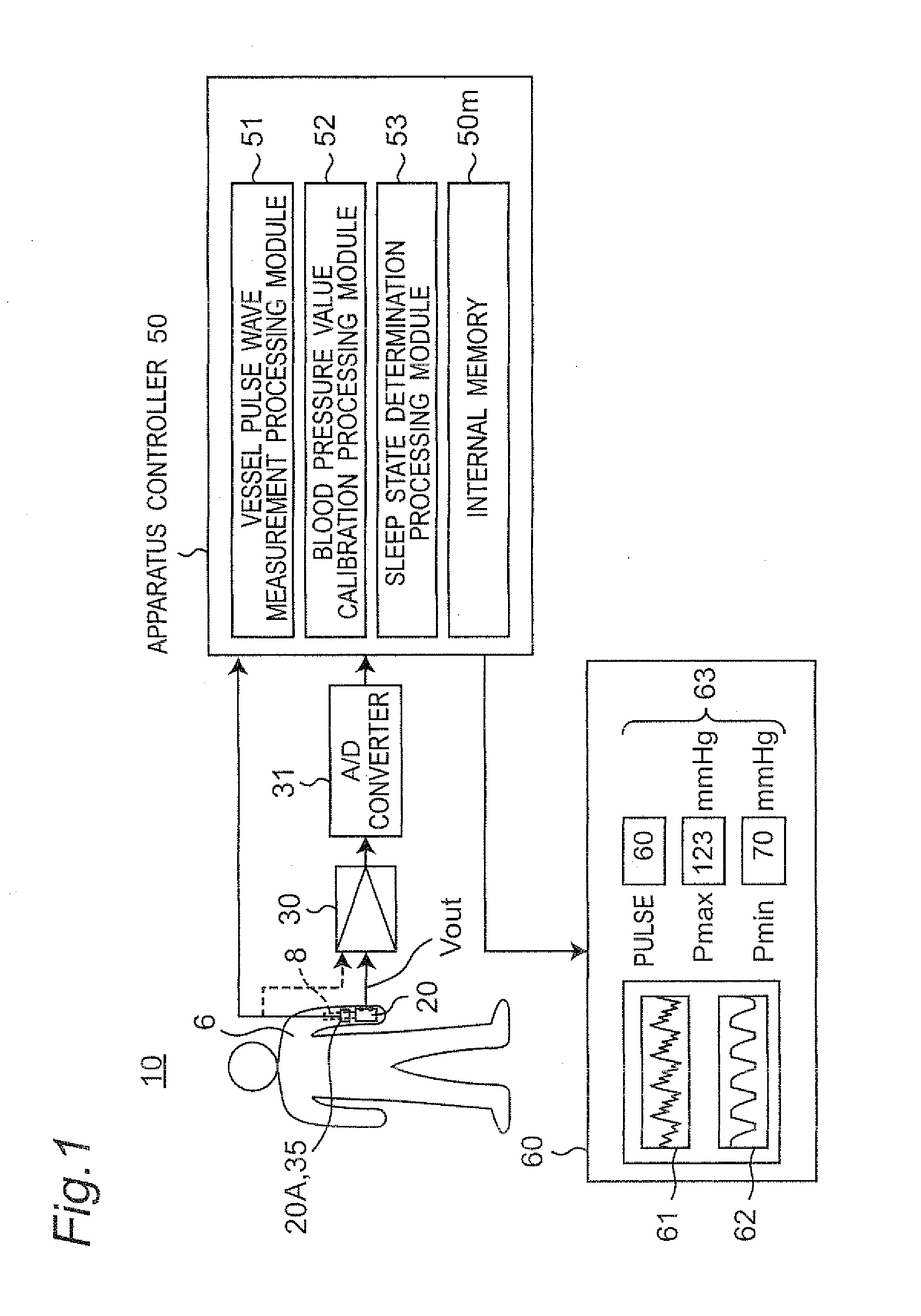 Vessel pulse wave measurement system conducting vessel pulse wave measurement by obtaining pulsation waveform of blood vessel