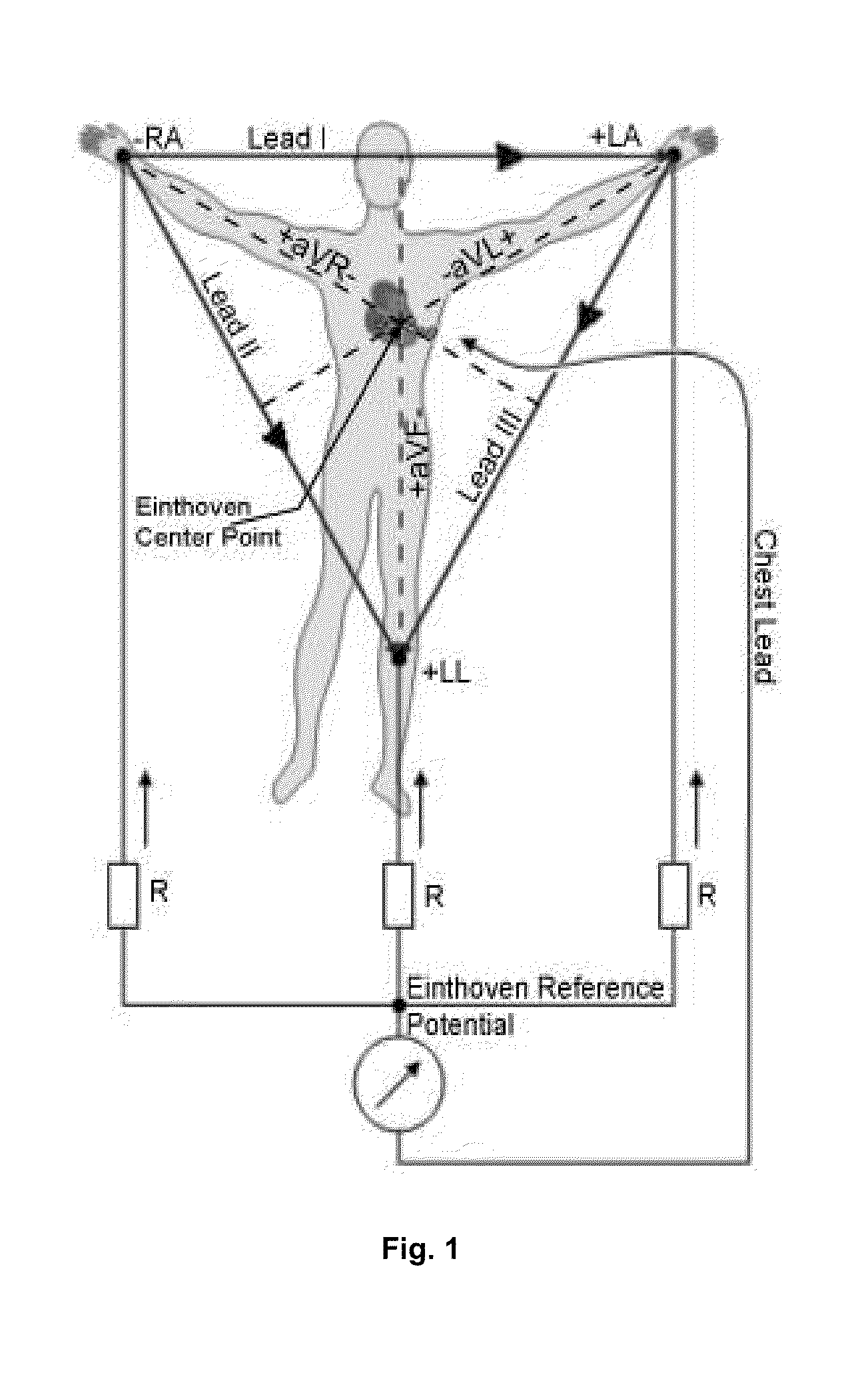 ECG device with impulse and channel switching ADC noise filter and error corrector for derived leads