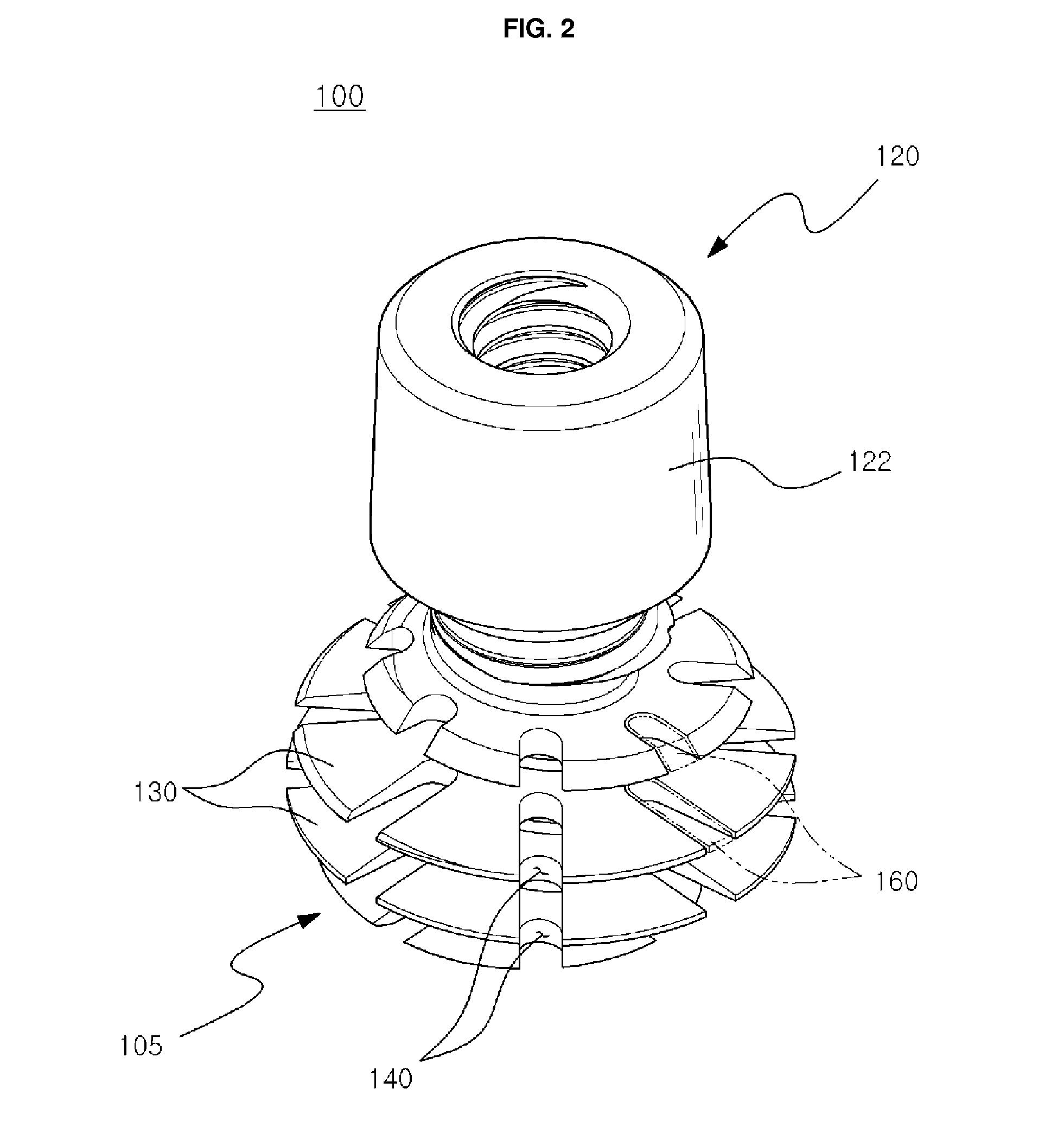 Dental implant