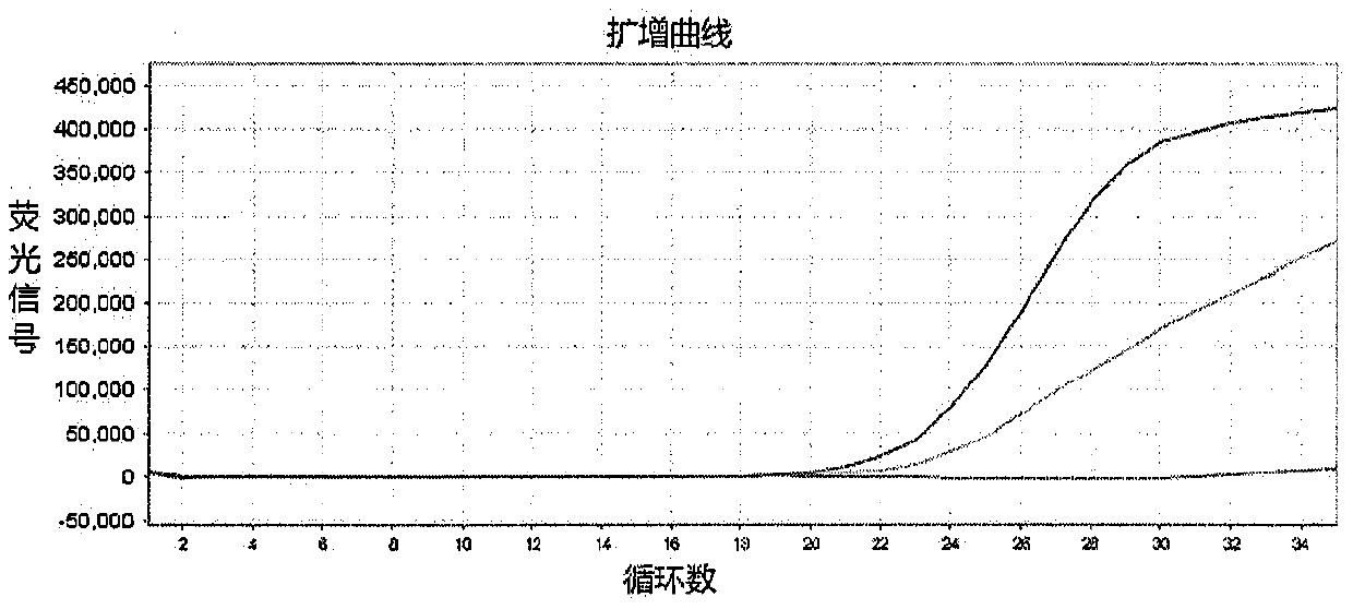 Establishment of methodology for detecting genes affecting efficacy of antihypertensive drugs by TaqMan-MGB probe technique