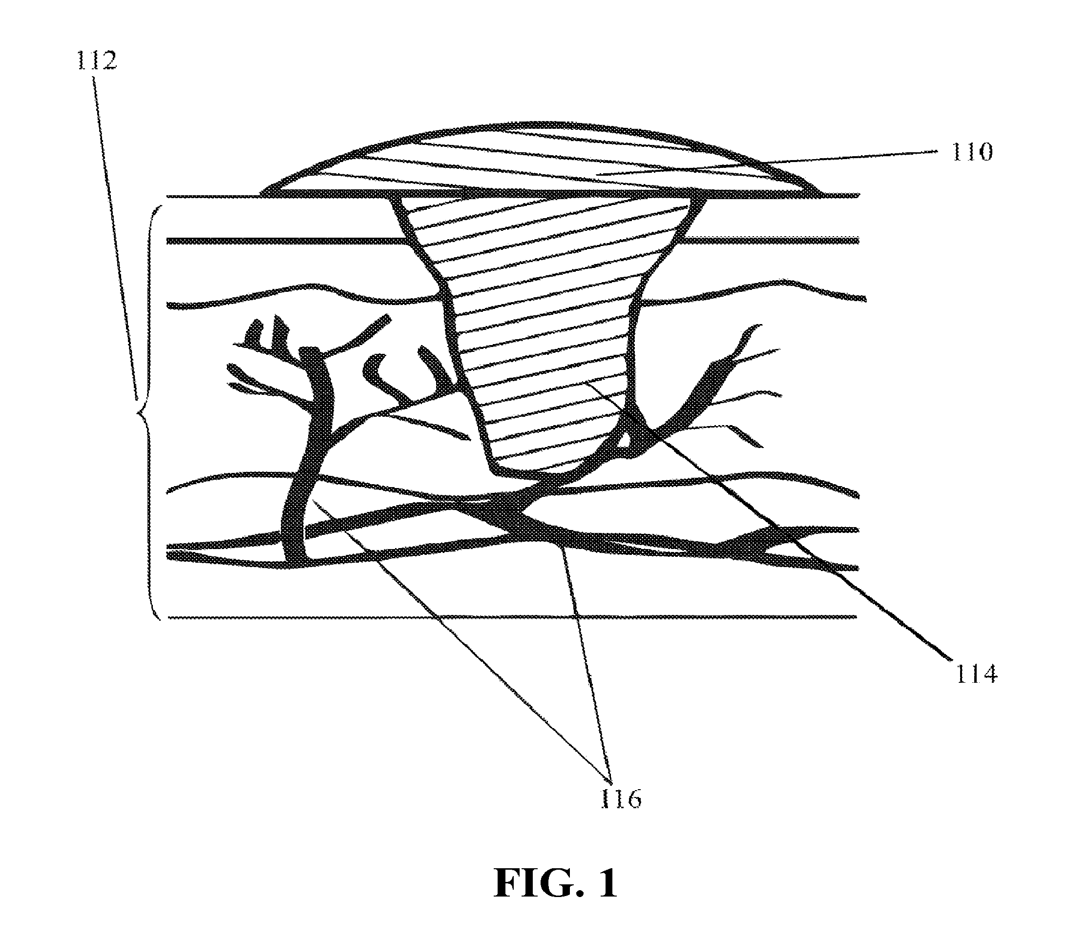 In-situ cross-linkable polymeric compositions and methods thereof