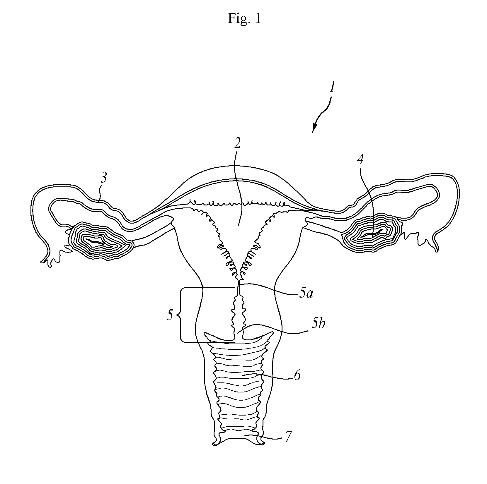 Amniotic fluid collector