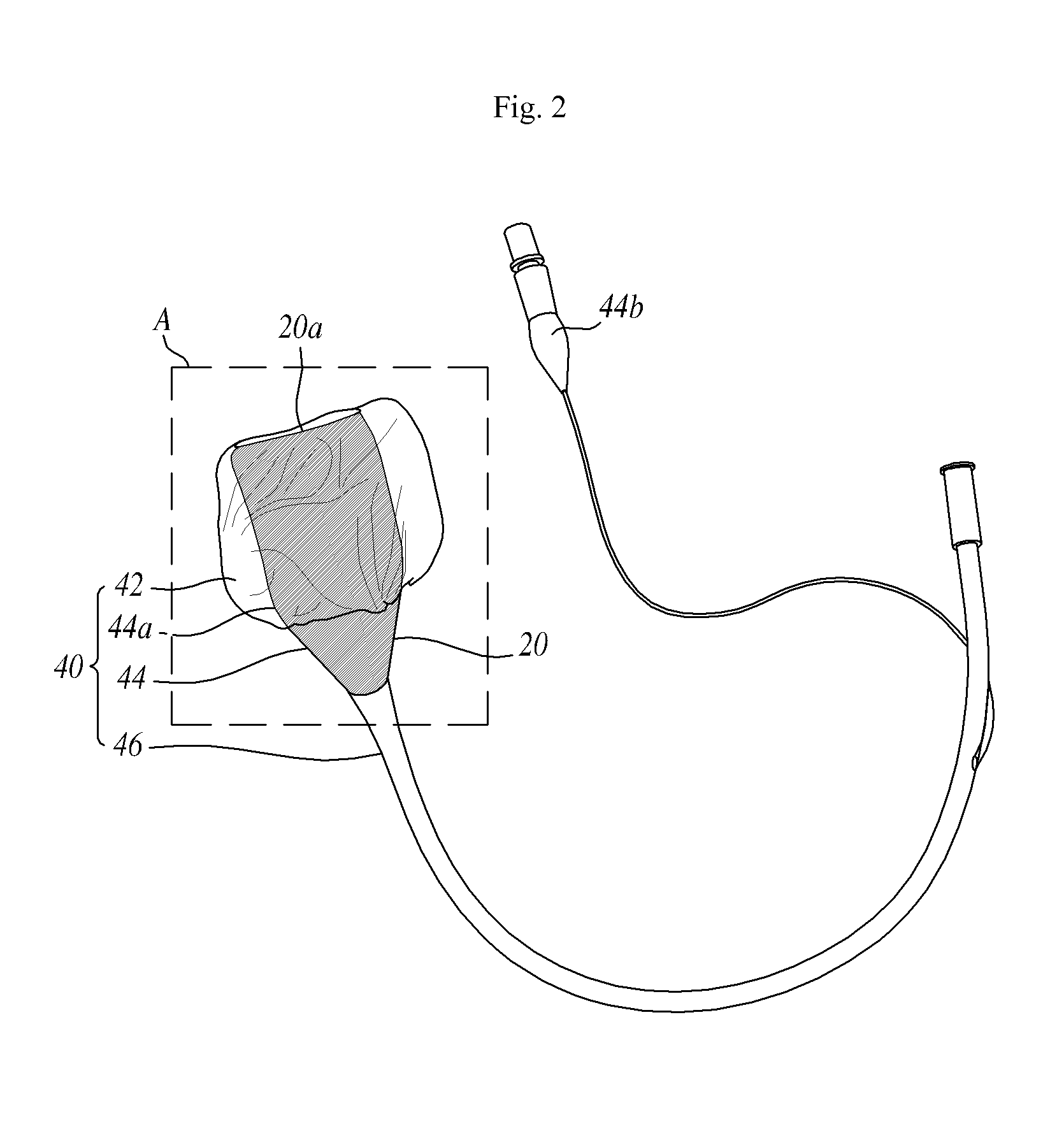 Amniotic fluid collector