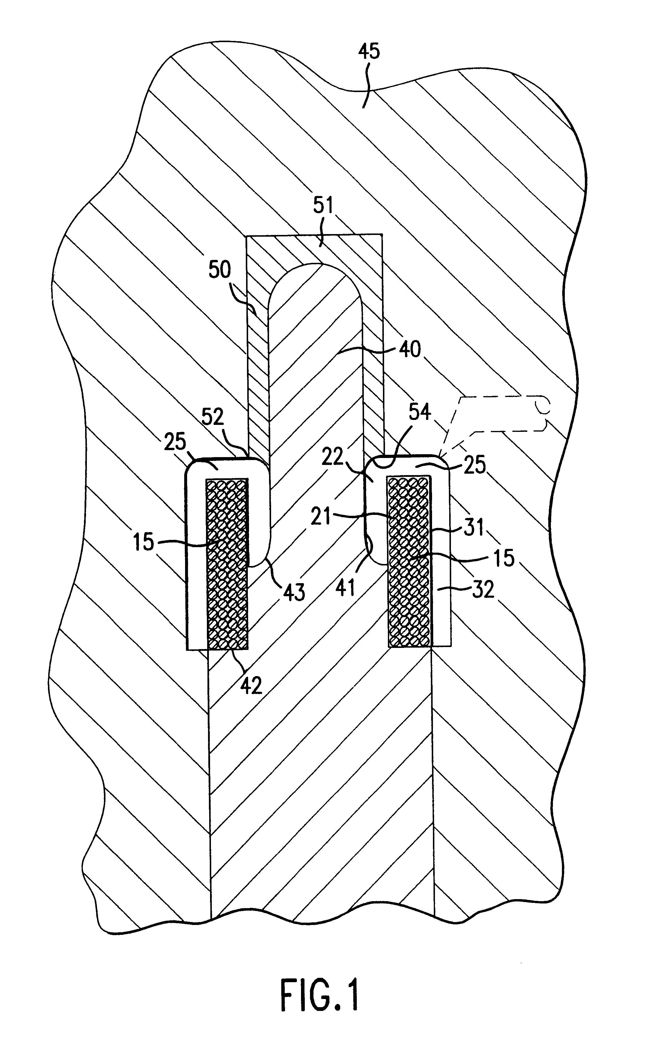 Method and apparatus for encapsulating a ring-shaped member