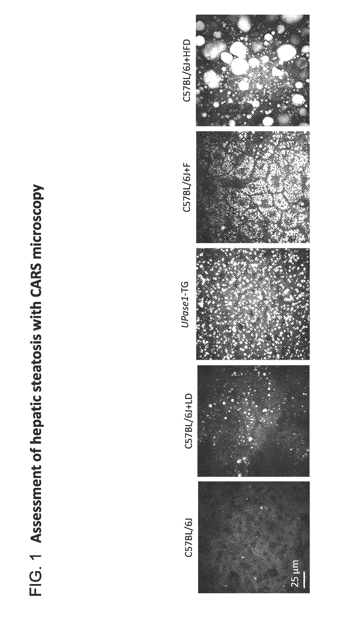 Methods for molecular classification of fatty liver by high-throughput protein post-translational modifications