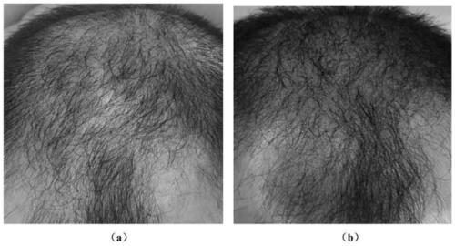 Fibroin-containing anti-hair loss and hair-solidifying shampoo composition and preparation method thereof