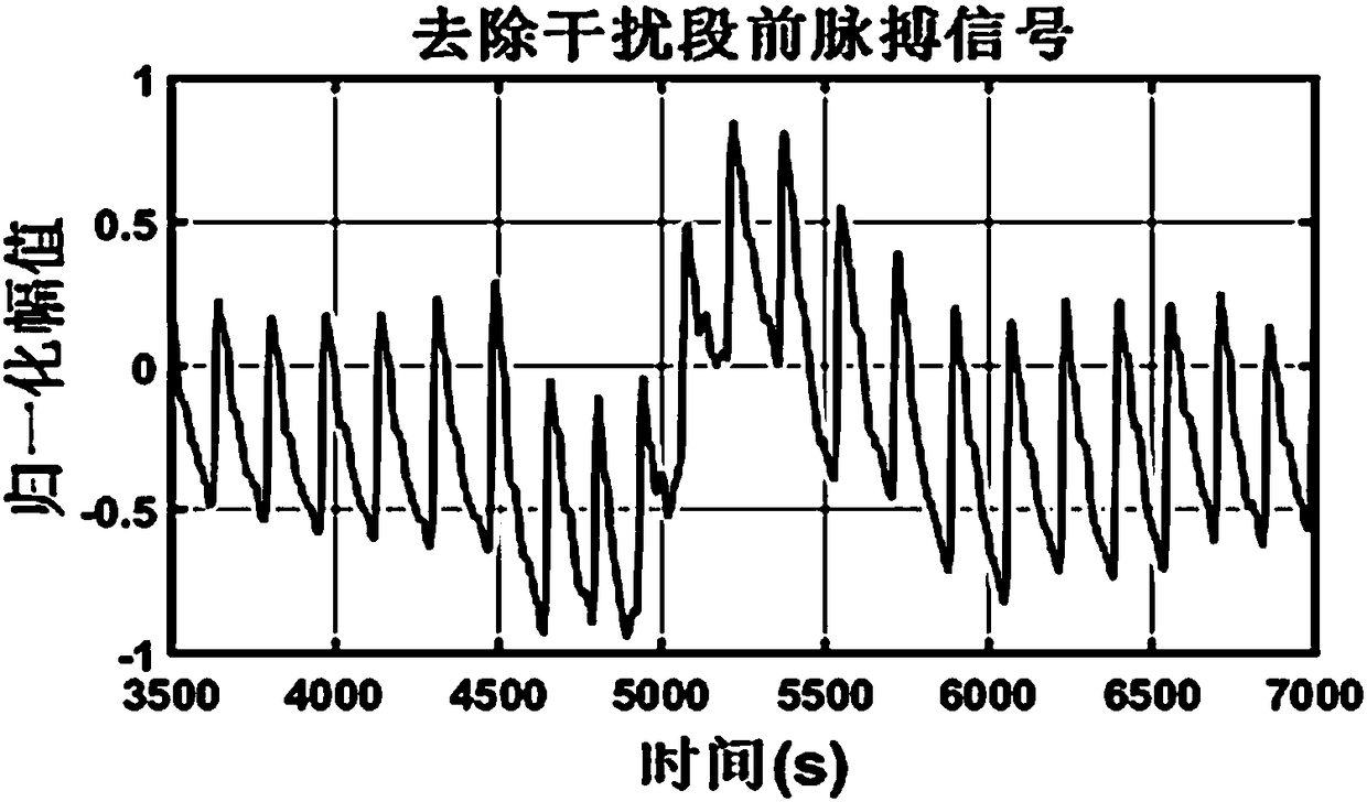 Pulse signal subhealth detection method and detection system based on PCANet