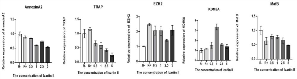 Application of baohuoside I in preparation of medicine for treating rheumatoid arthritis and osteoporosis and medicine